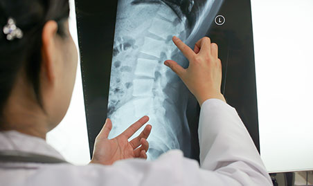 Doctor exams spine for severity of facet syndrome